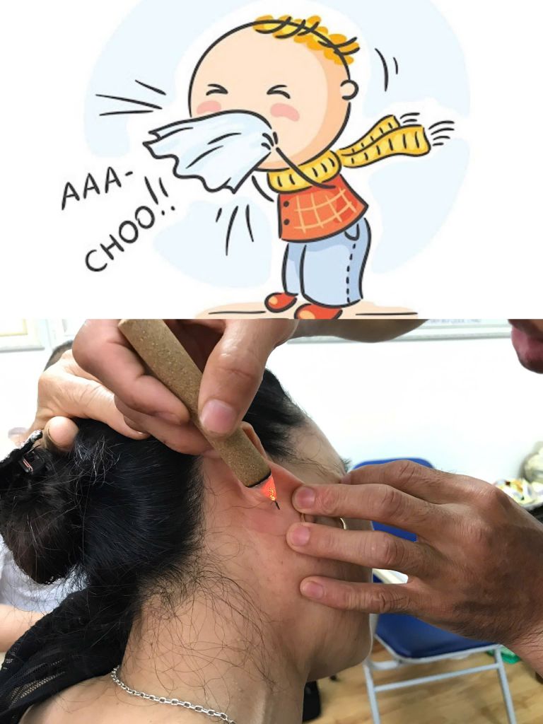 Diện Chẩn chữa cảm lạnh